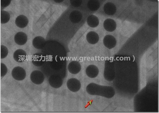 BGA因為焊墊變小，造成錫膏過多而最終形成焊接短路的結果。